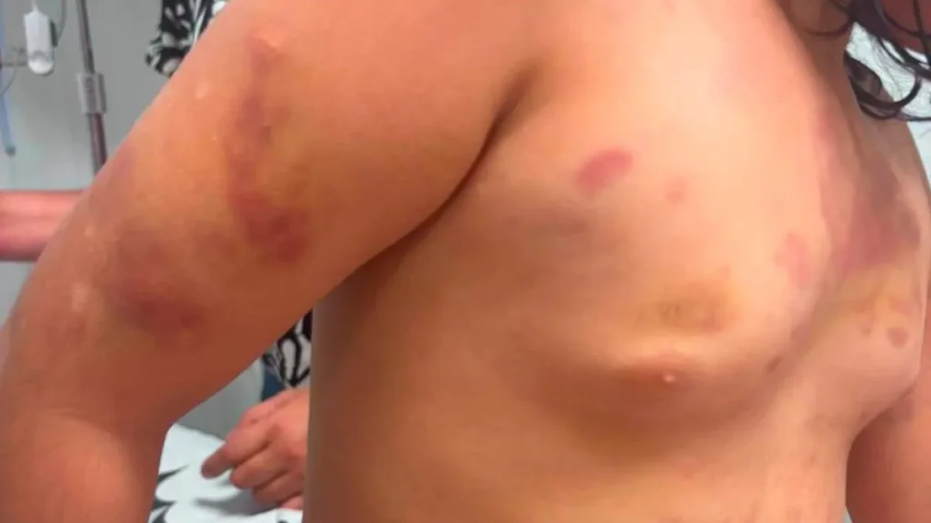 Brazil stepfather arrested after 6-year-old hospitalized with injuries