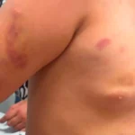 Brazil stepfather arrested after 6-year-old hospitalized with injuries