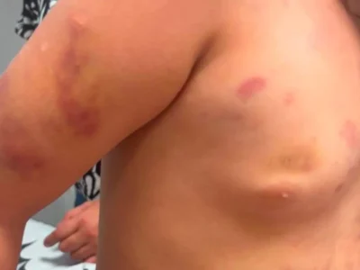 Brazil stepfather arrested after 6-year-old hospitalized with injuries