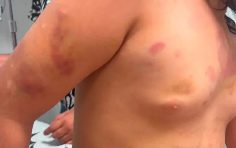 Brazil stepfather arrested after 6-year-old hospitalized with injuries