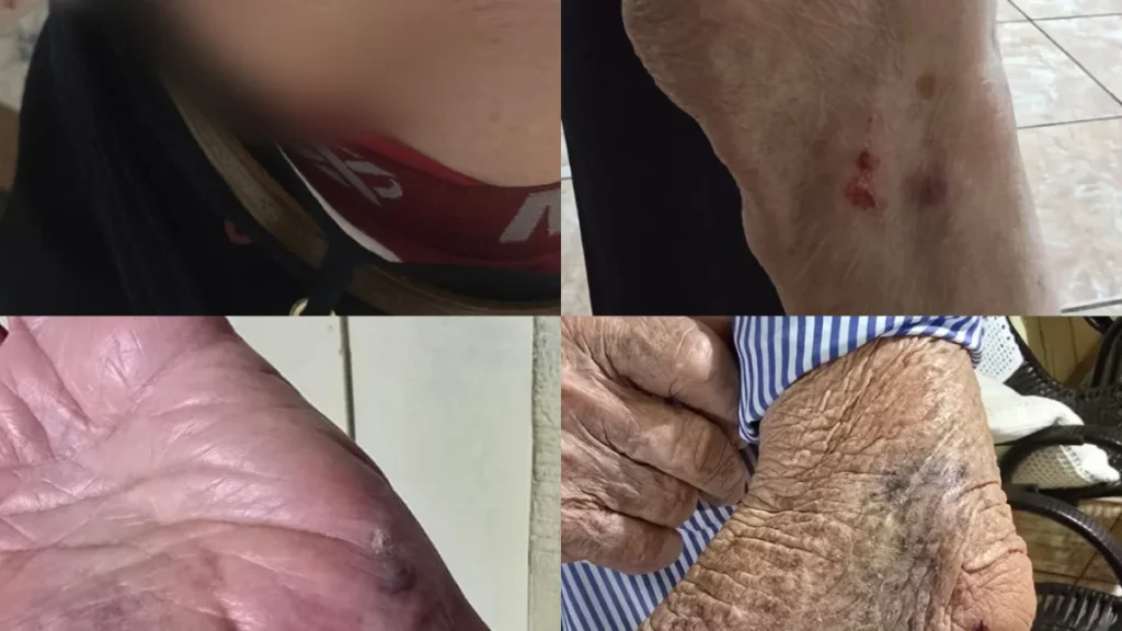 Brazil dog knocks down, bites 87-year-old man on way to market